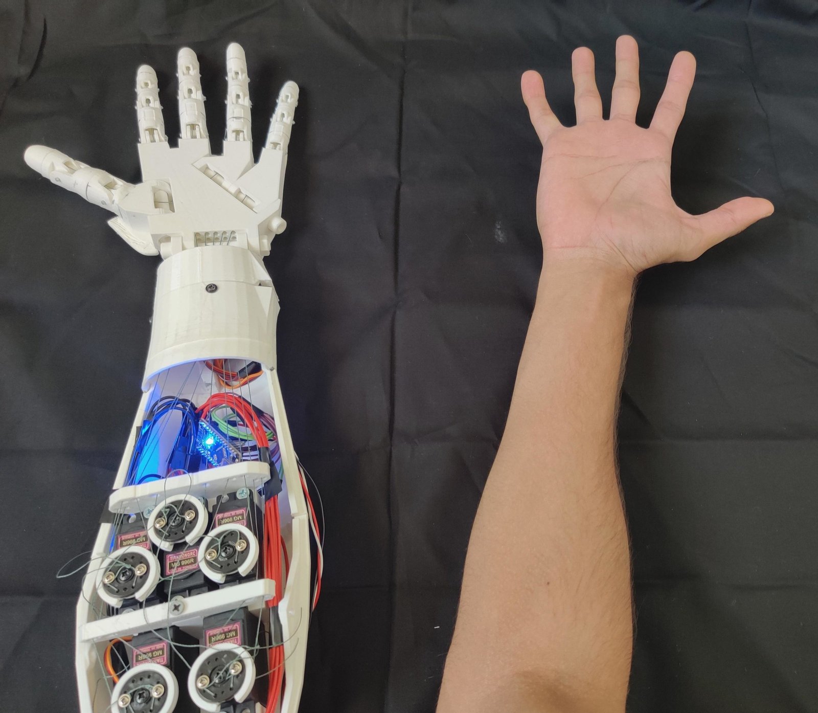 Designing a 3Dprinted EMG bionic hand as a lowcost alternative to