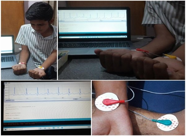 Real Time Handheld ECG Display
