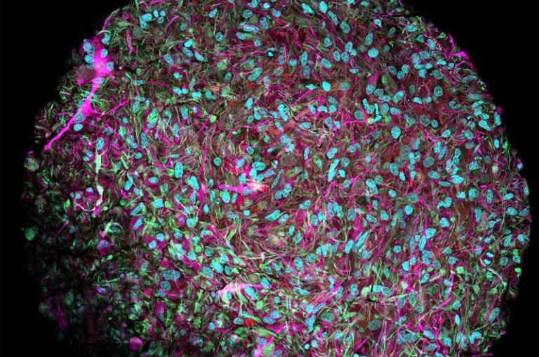 Bio-Computers Becomes The New Frontier Of Intelligence.